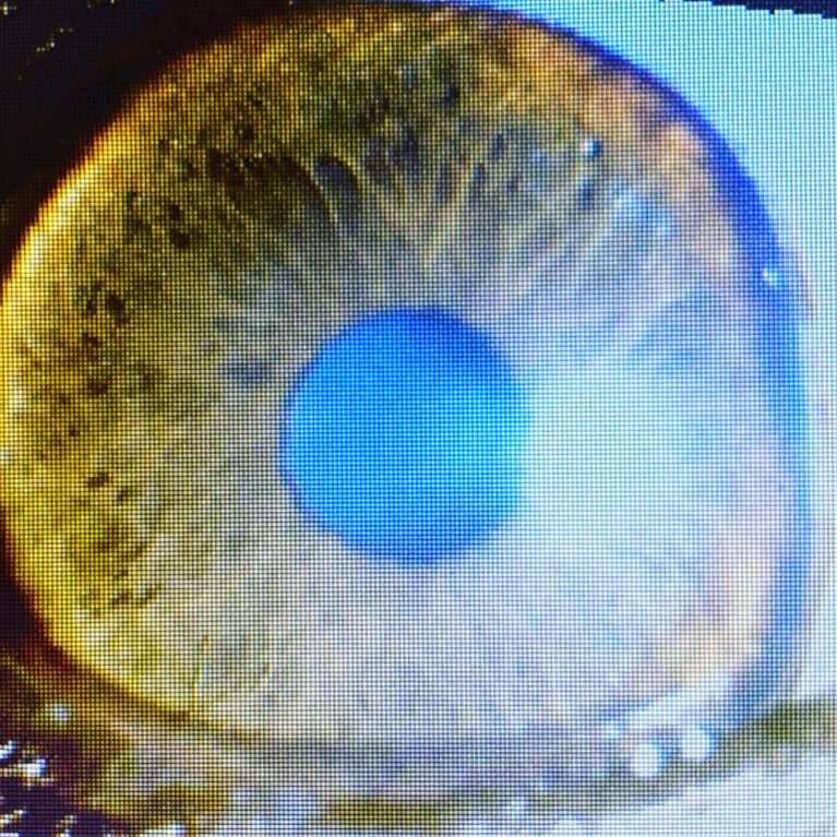 クッシング症候群の子の眼